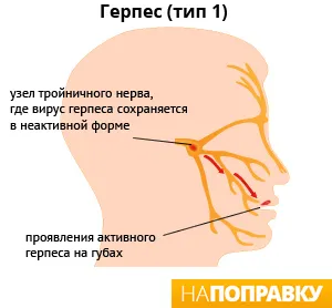 Активация герпесной инфекции