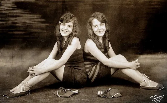 10 удивительных историй самых известных сиамских близнецов (16 фото)