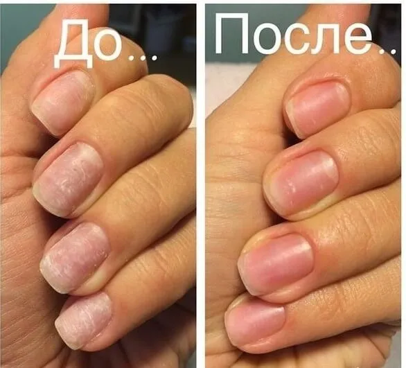 Укрепление ногтей биогелем до и после