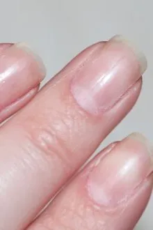 Главные проблемы ногтей после гель-лака