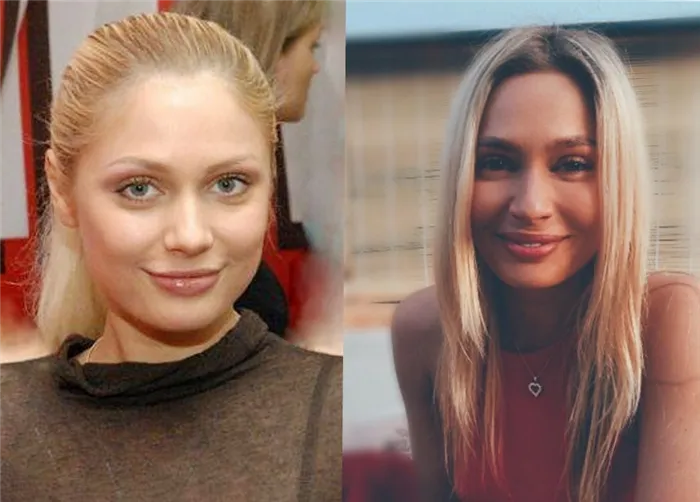 Наталья Рудова до и после пластики фото