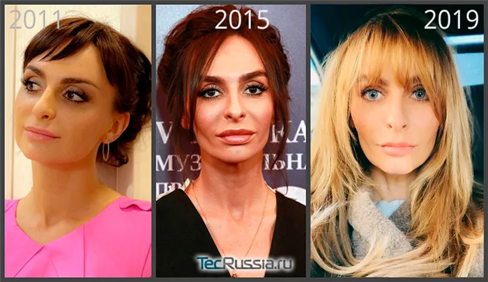 Екатерина Варнава увеличила губы, фото с 2011 по 2019 год