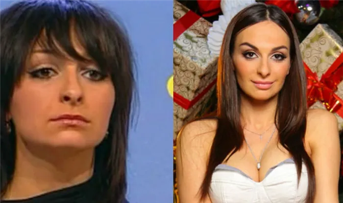 Екатерина Варнава до и после пластики