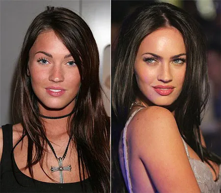 Меган Фокс – фото до и после пластических операций