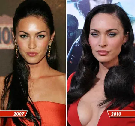 Меган Фокс – фото до и после пластических операций