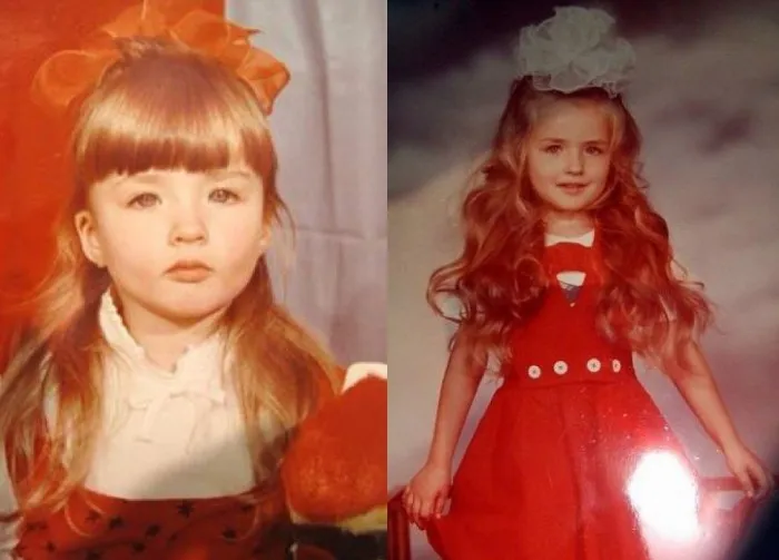 Лукьянова Валерия до и после пластики. Фото девушки Барби (Аматуе) в Инстаграм, Вконтакте
