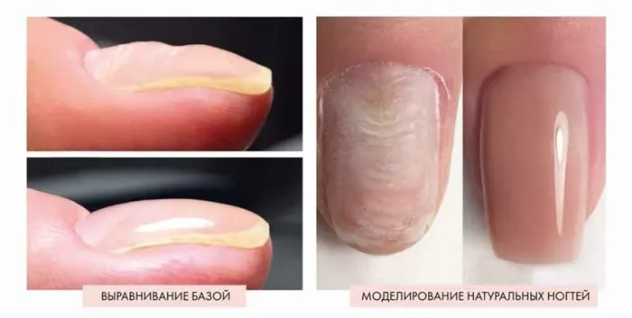 выравнивание ногтевой пластины гелем