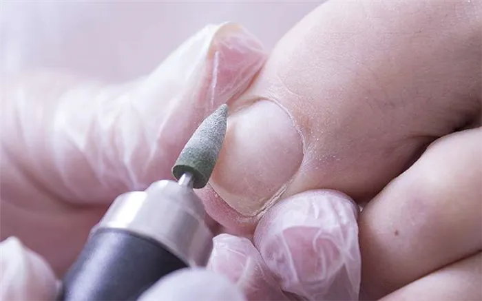 Обработка ногтевых пластин при аппаратном педикюре