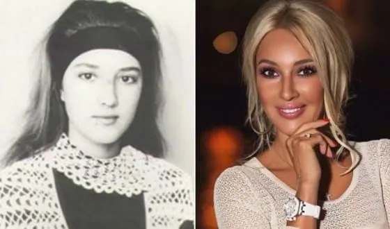 Лера Кудрявцева. Фото до и после пластики, в молодости, без макияжа, возраст, параметры фигуры. Как изменилась звезда