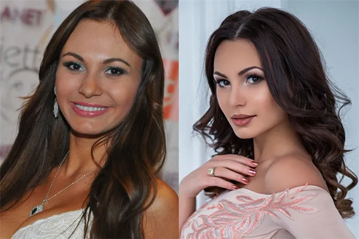 Инна Жиркова фото до и после