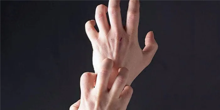 Причины шелушения кожи рук
