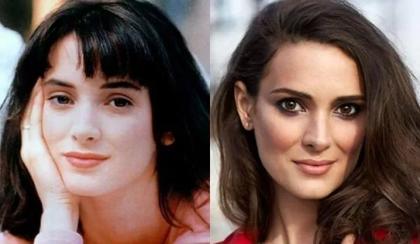 До и после пластики носа