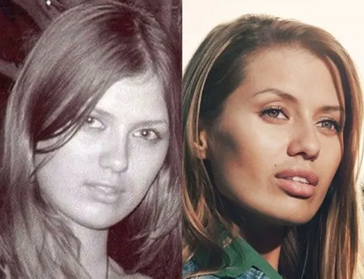 Виктория Боня до и после пластики - фото, личная жизнь, рост, вес. Новые пластические операции