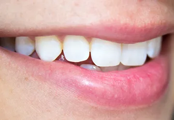 светлые зубы