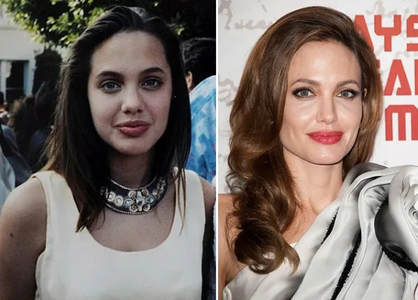 Анджелина Джоли до и после пластики. Подборка фото актрисы до и после операций ринопластики, плазмолифтинга