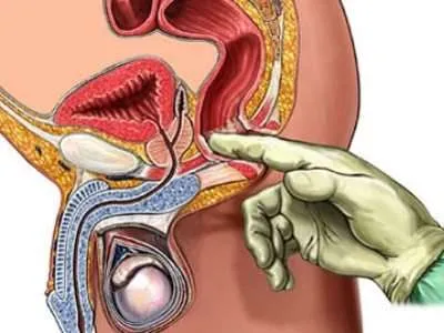 техники массажа простаты